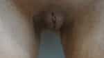 Labia Minoraplasty