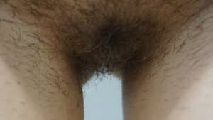 Labia Minoraplasty