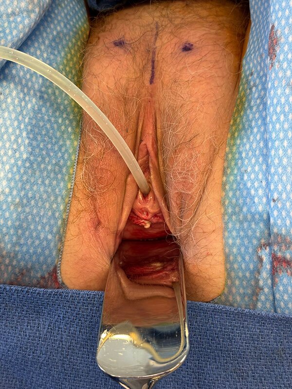 Sling Photo