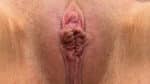 Labia Minoraplasty