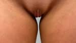 Labia Minoraplasty